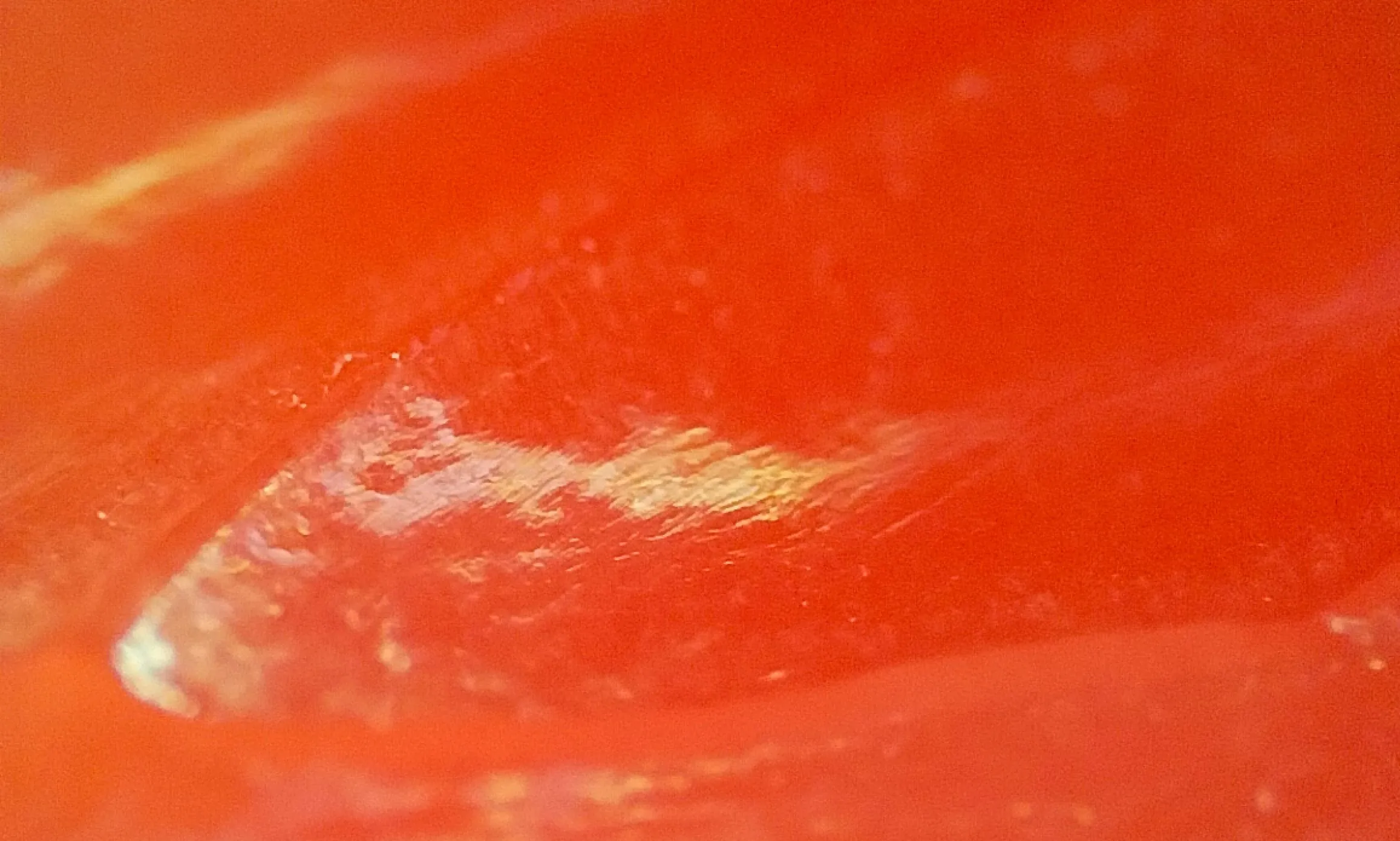 Microlens