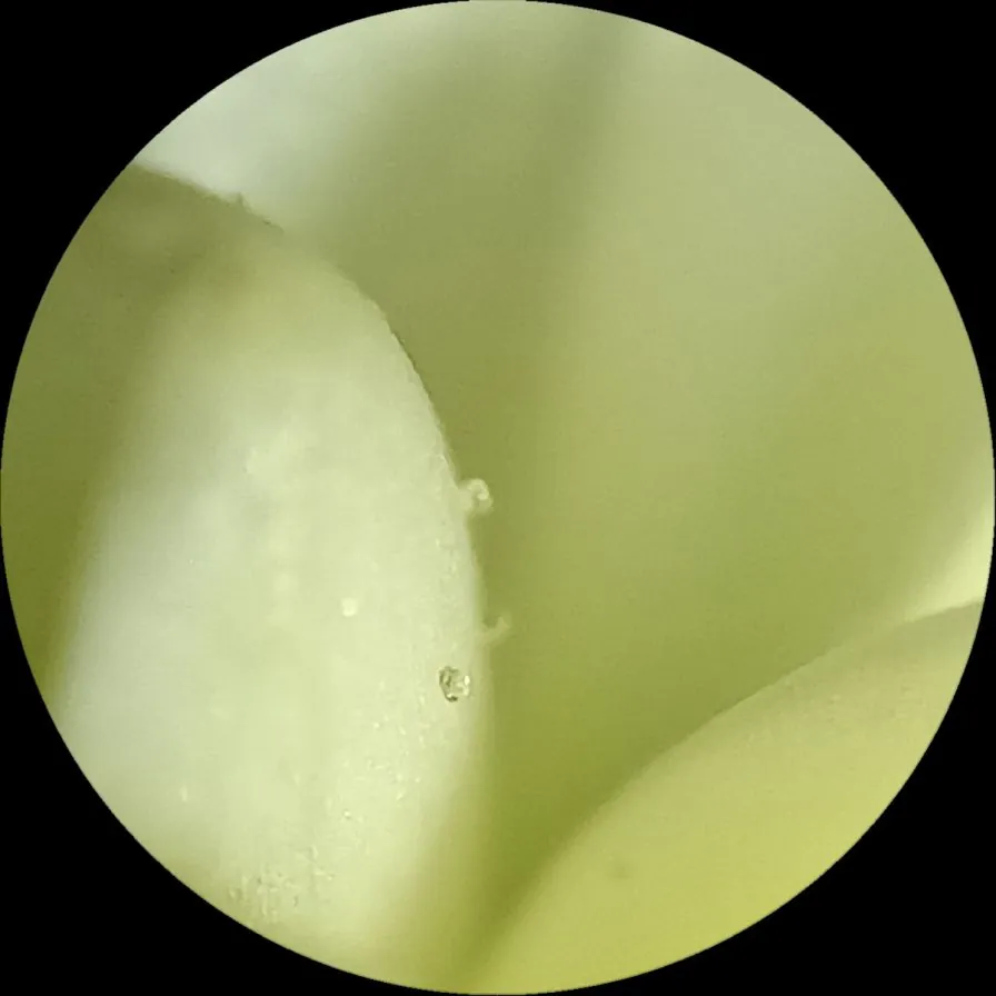 صورة بتقنية ال Microlens